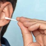 Ear Microsuction Hendon
