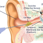 Ear Microsuction Edgware